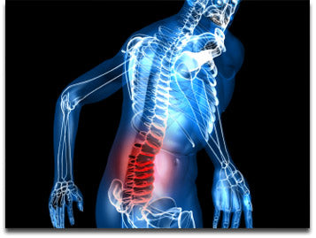 Le CBD contre la Sciatique